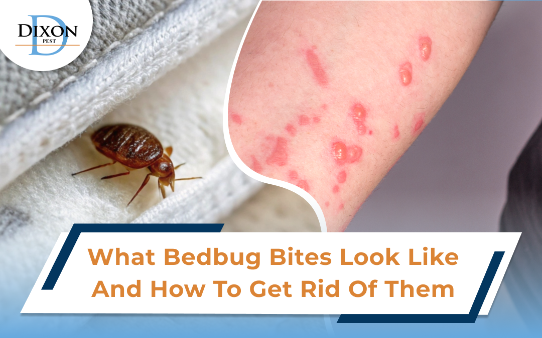 What Bedbug Bites Look Like and How to Get Rid of Them